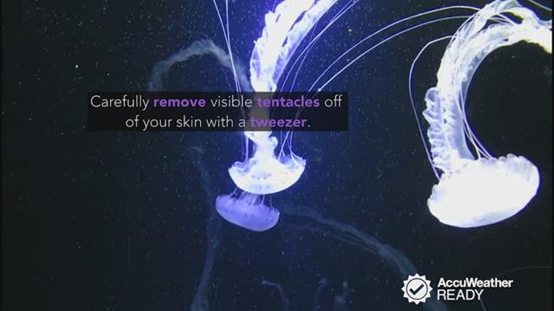 What should you do if you are stung by a jellyfish?