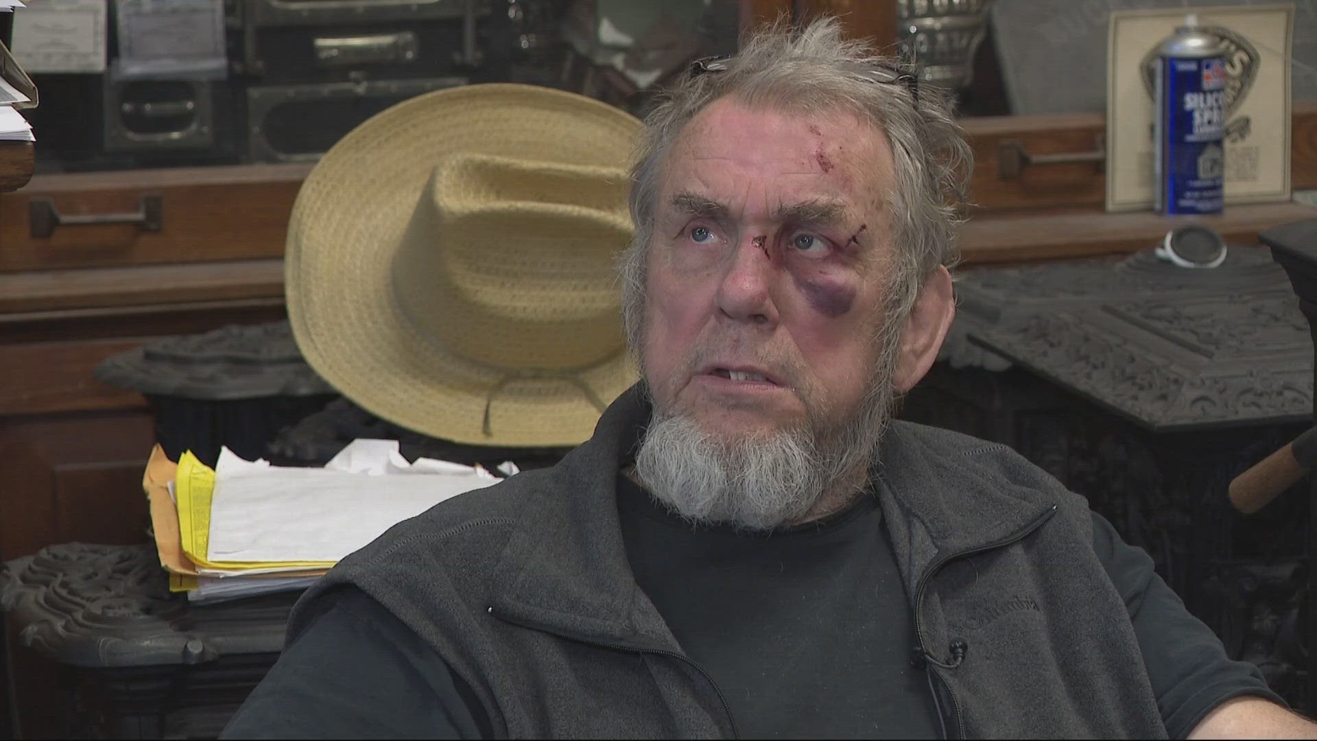 Store owner, Buck Froman got a black eye after falling while trying to confront thieves during one of several recent break-ins.