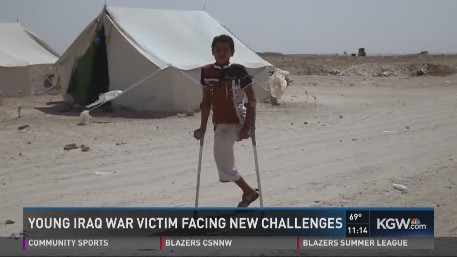 Young Iraq war victim facing new challenges