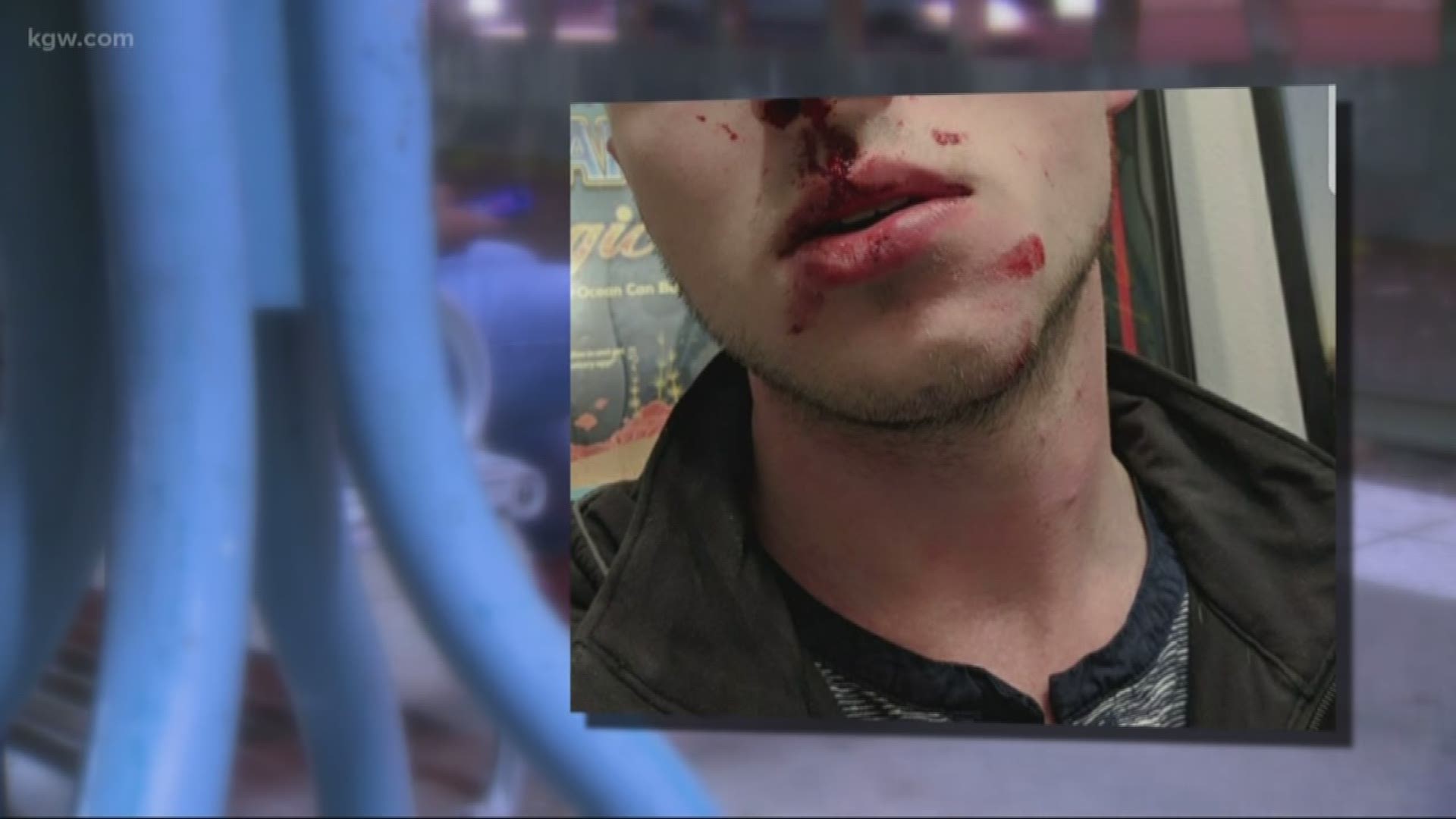 A Portland father is warning others after he says his son was attacked by a stranger on the MAX in Northeast Portland.