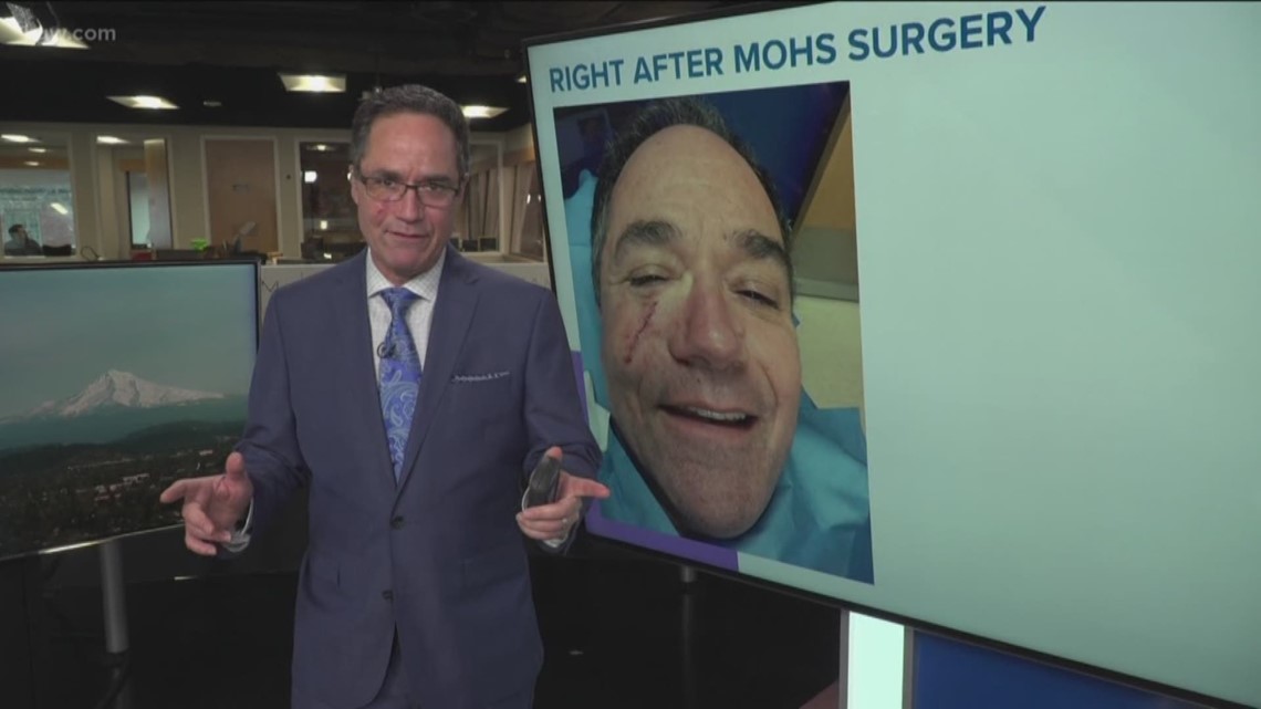 Matt Zaffino shares his scare with melanoma