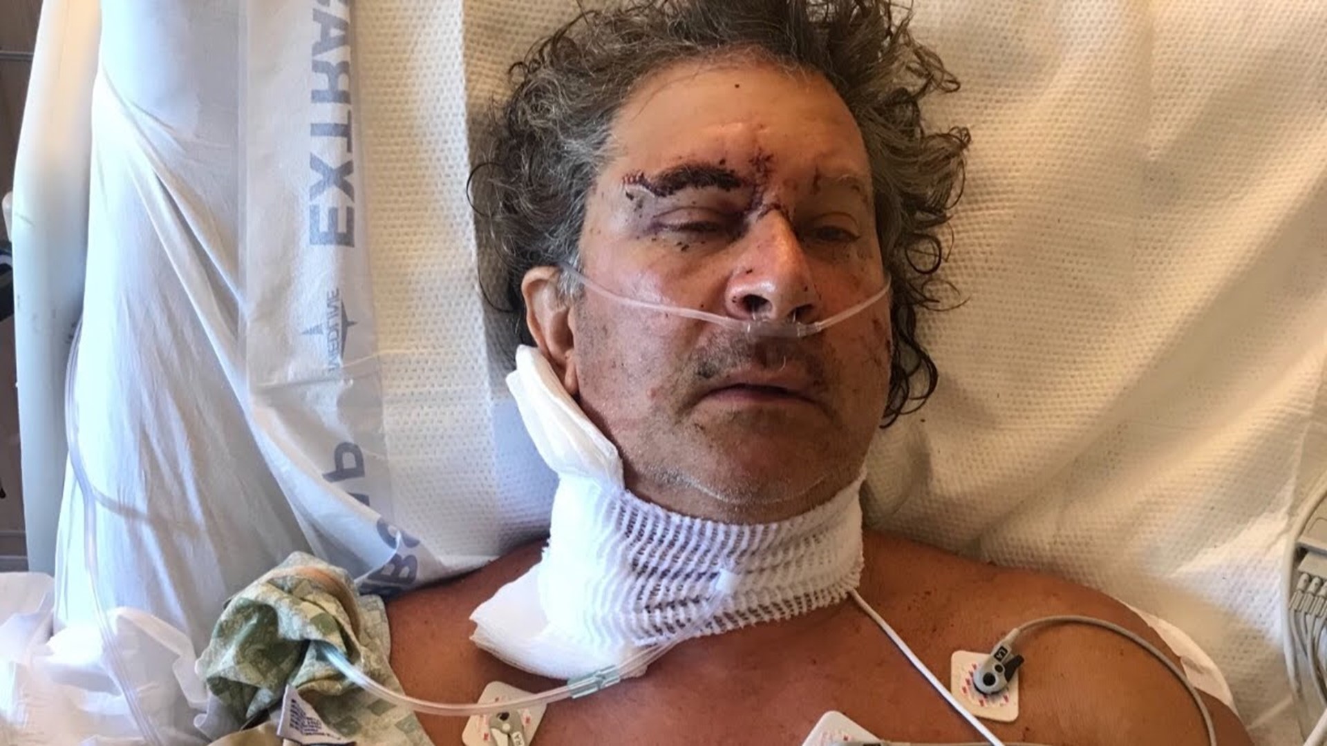 Man stabbed 17 times after telling homeless man not to camp, daughter ...