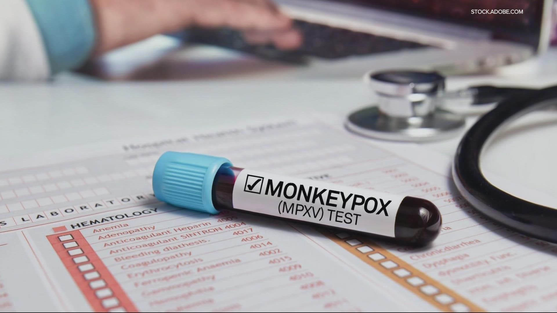 Health officials held a virtual update on Thursday about the current extent of monkeypox in Oregon. They noted that 57 of the known cases are in Multnomah County.