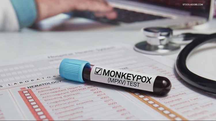Oregon identifies its first pediatric case of monkeypox