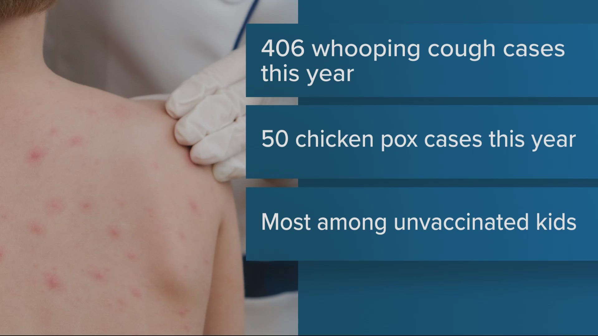 The Clark County Public Health Department says it has the highest rate of whooping cough in Washington state.