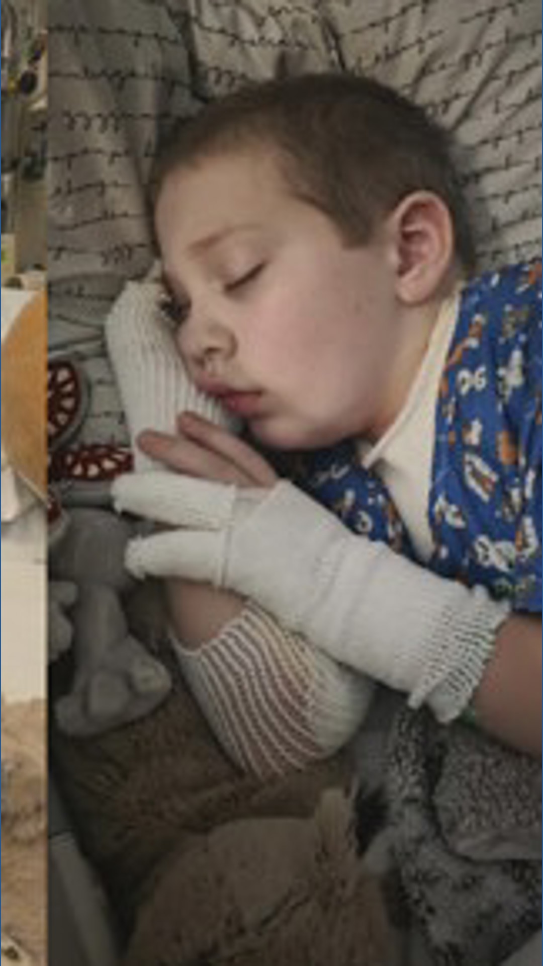 Family warns parents after toy explosion leaves 7-year-old with severe ...