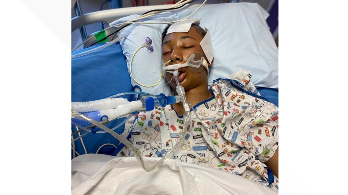 Teen hit in head by tire iron shows signs of improvement in ICU