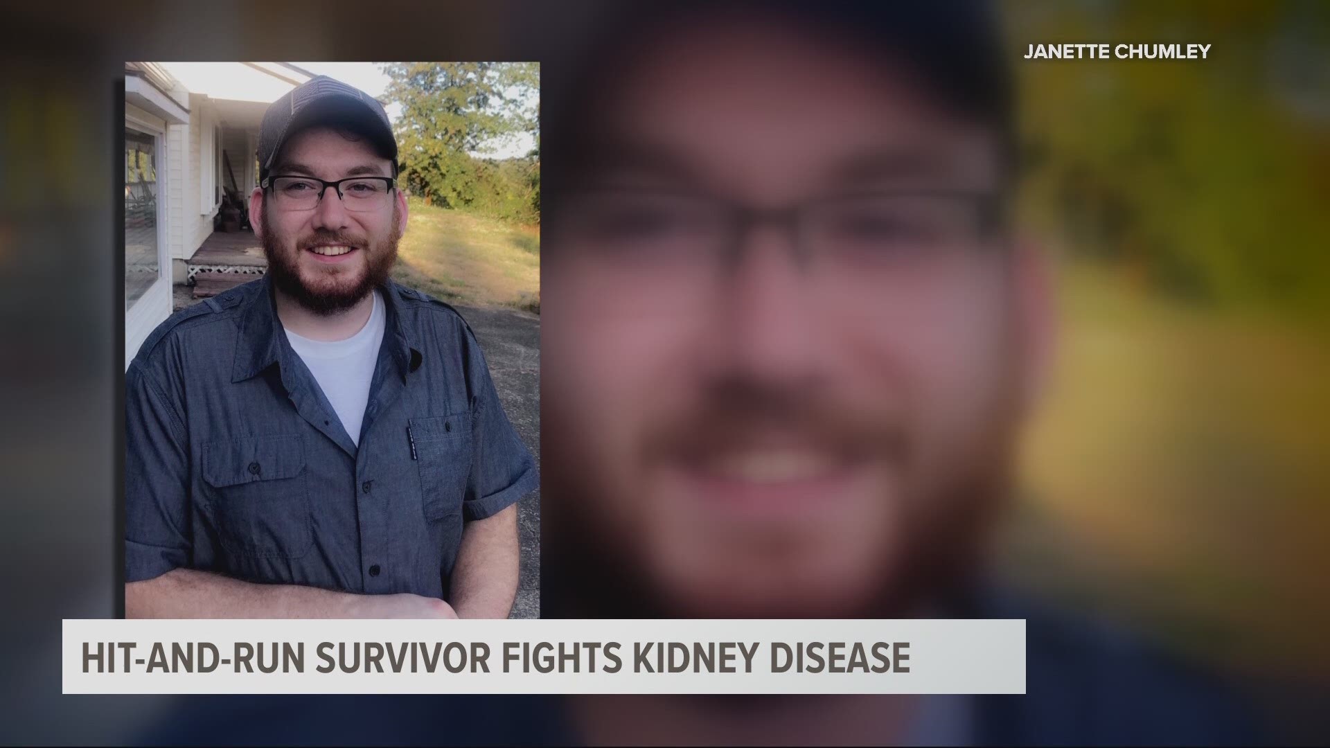 A Battle Ground, Washington man is fighting for his life. Justin Carey needs a kidney transplant. Carey lost his leg in a 2013 hit-and-run crash. Support has been pouring in online for Justin and his family, but what he needs most is a kidney donor to save his life.