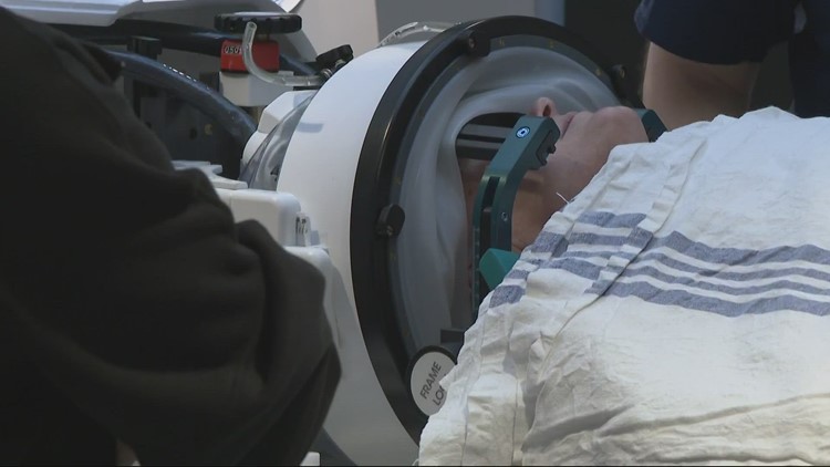 Artist’s tremor reversed with no-cut brain surgery at OHSU