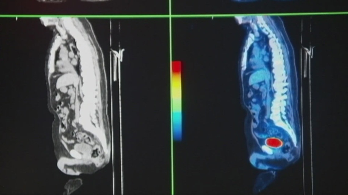 Oregon surgeons use new way to - C817f66c 9b67 4a07 Bd97 86251fa066e0 1140x641