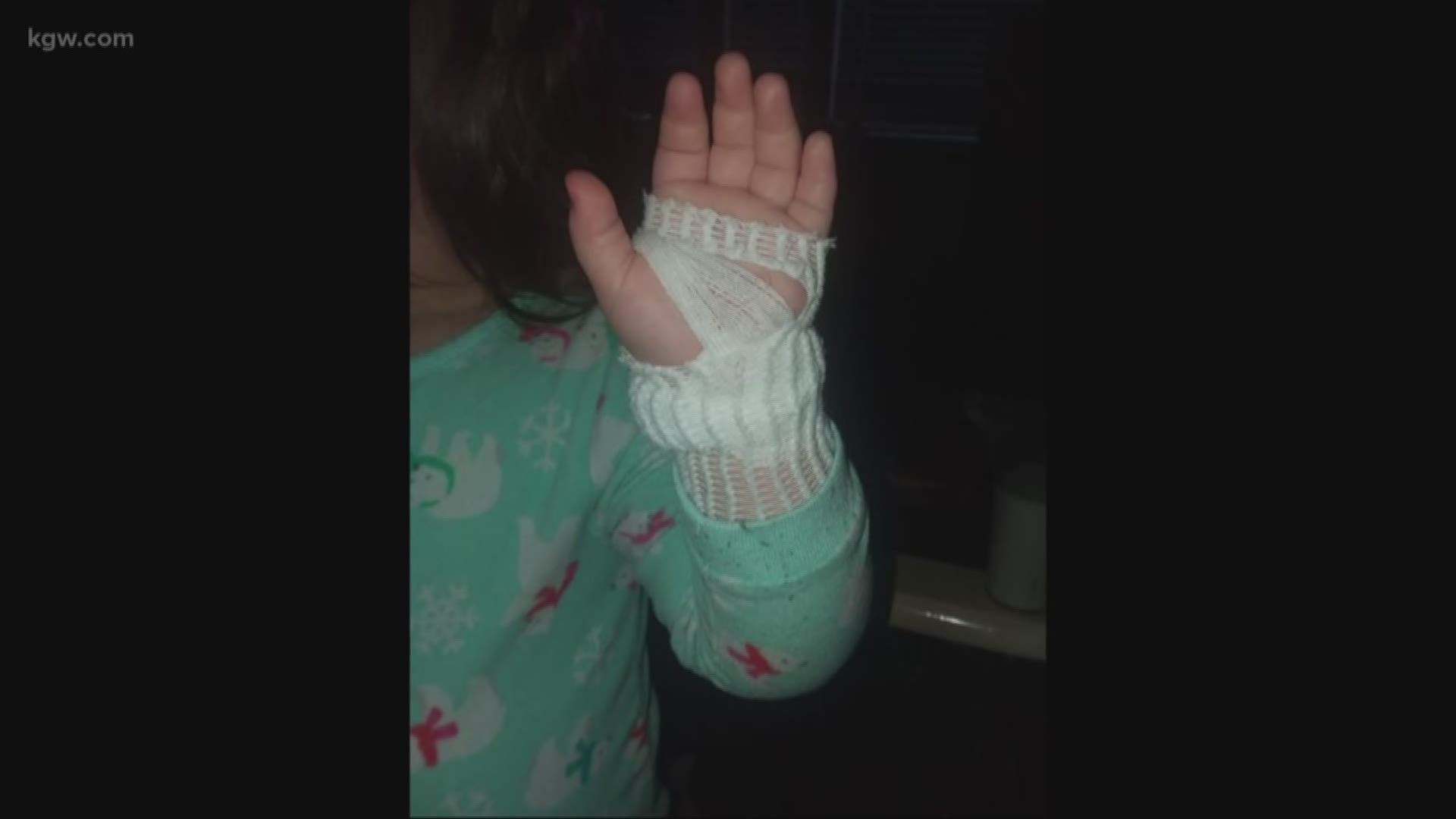 A Portland toddler slipped her hand into a gap in the baseboard heater warming her bedroom. Now her mom is warning other parents.