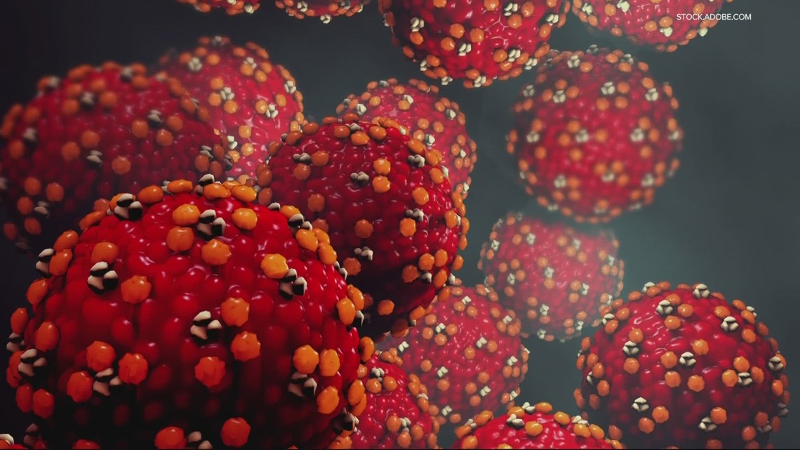 New measles exposure site reported at urgent care clinic in Happy Valley