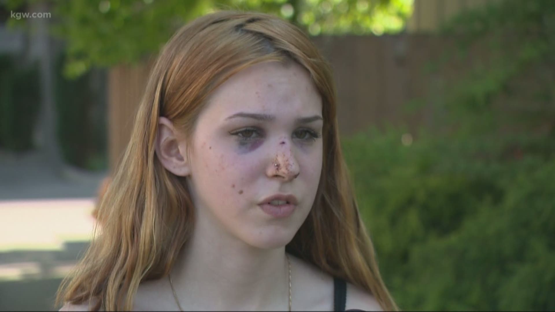 Teens beat up near Gresham park