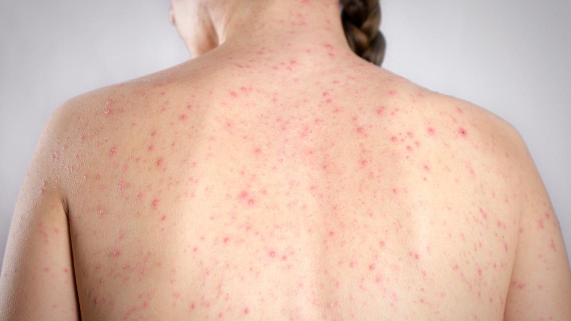 e5e4d321-0f10-4f5f-813c-e6e63d73595b_114