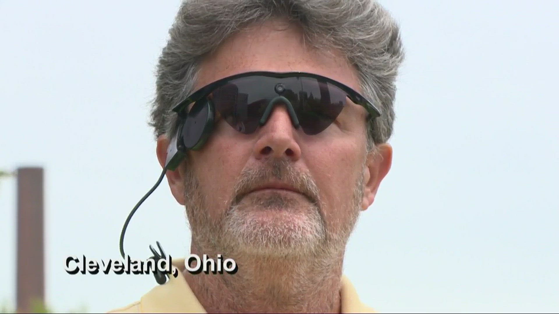 Man with bionic eye