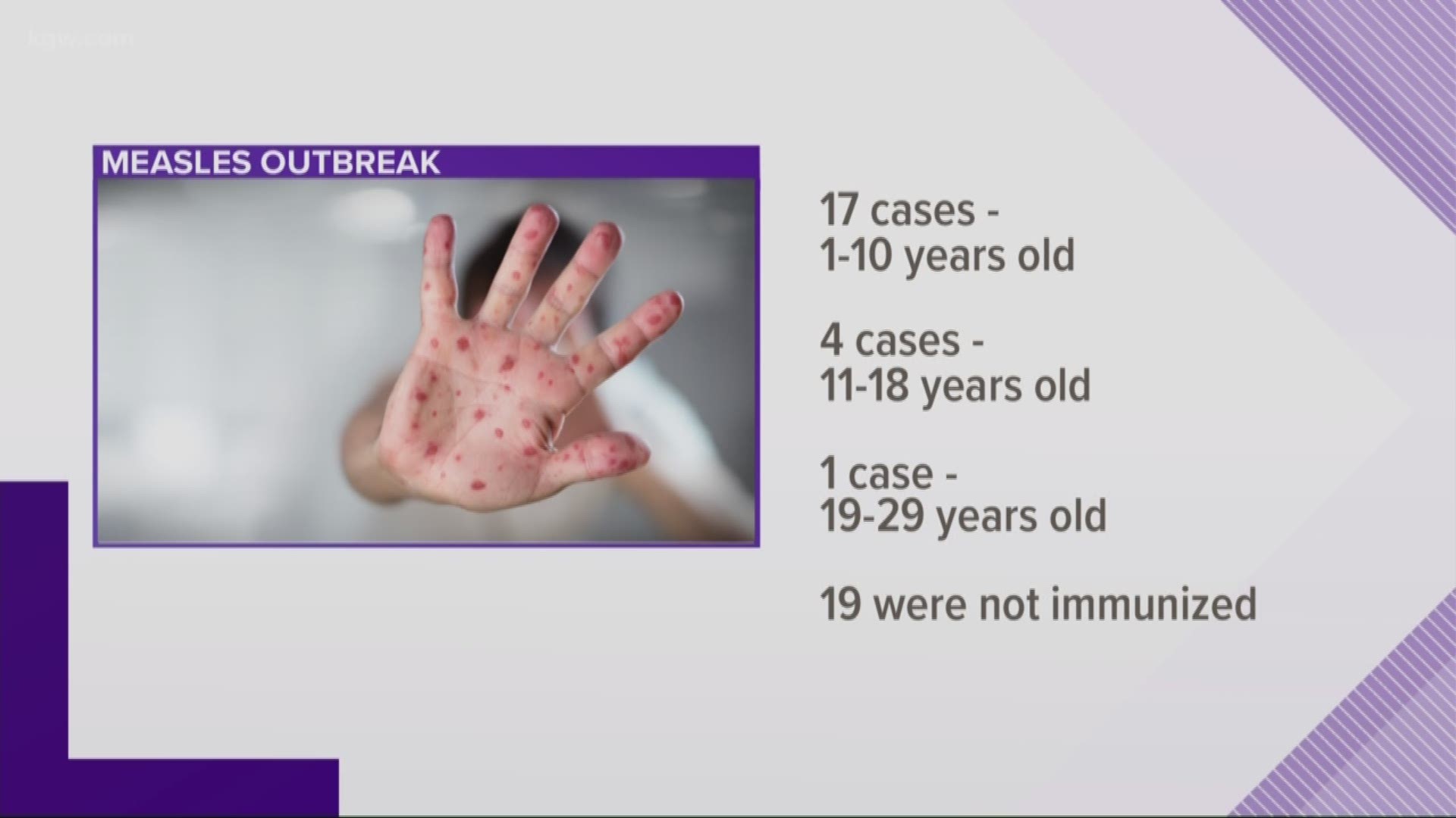22 confirmed measles cases in Clark County