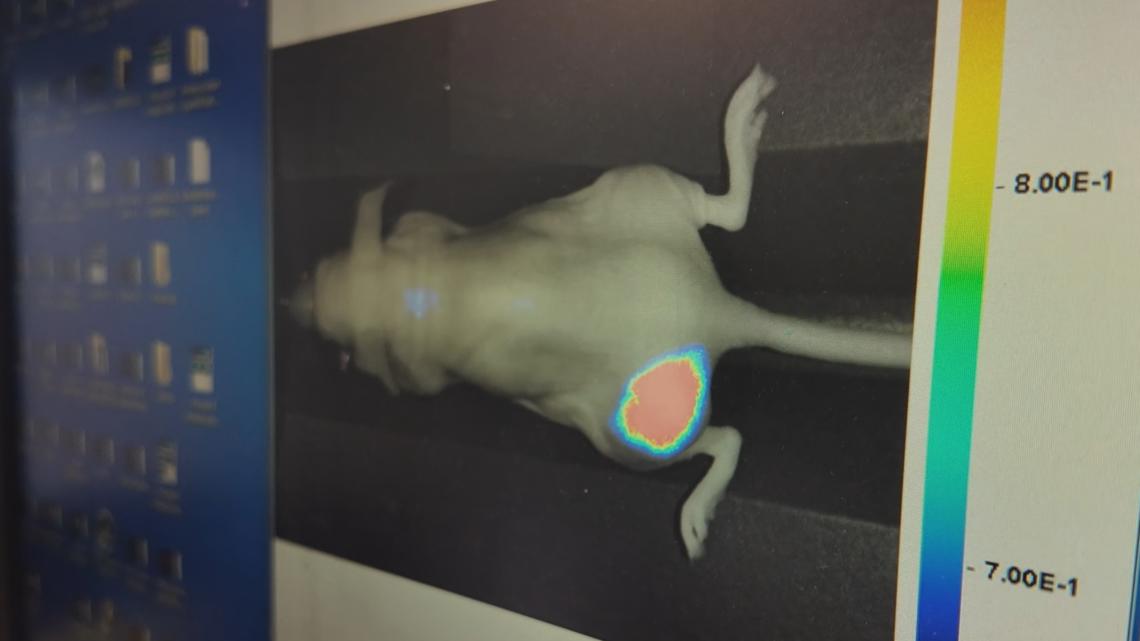 OSU researchers develop nanoparticle that kills melanoma