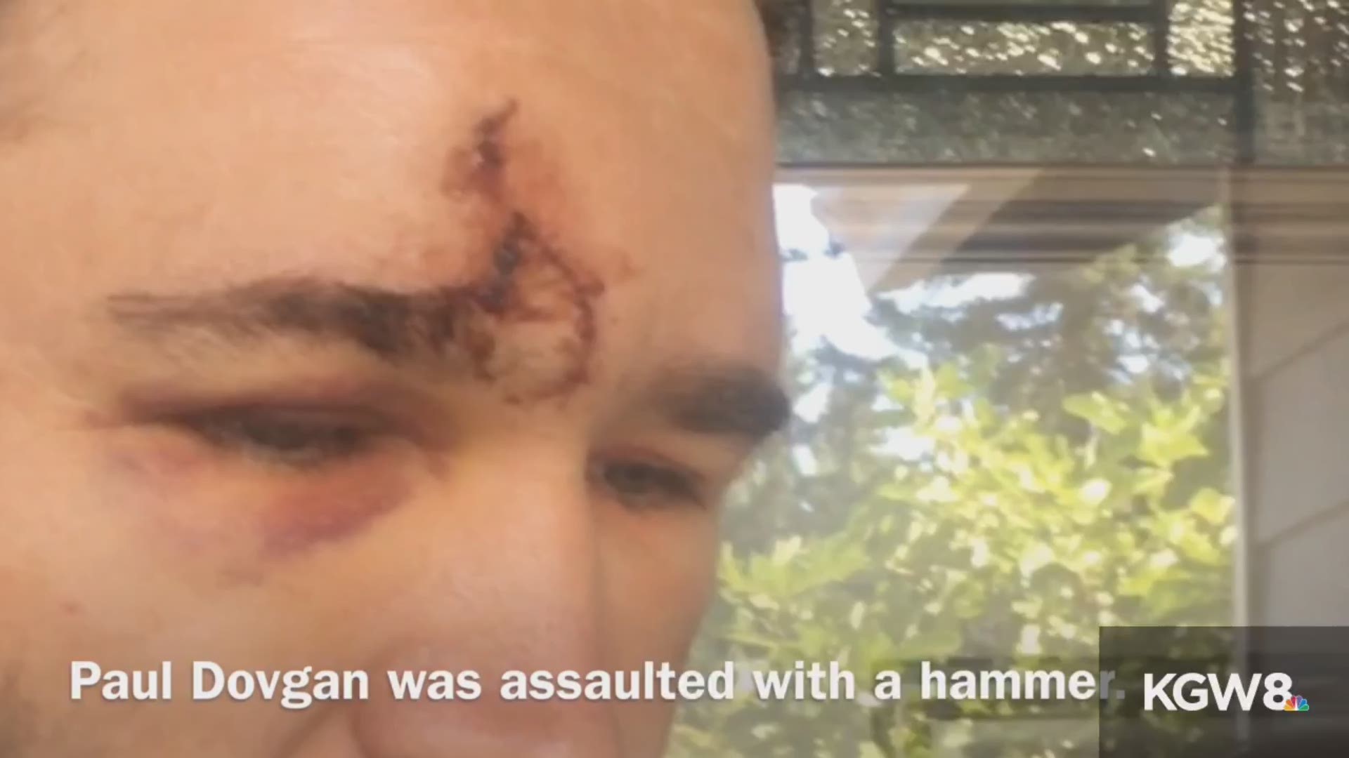 Paul Dovgan was assaulted with a hammer.