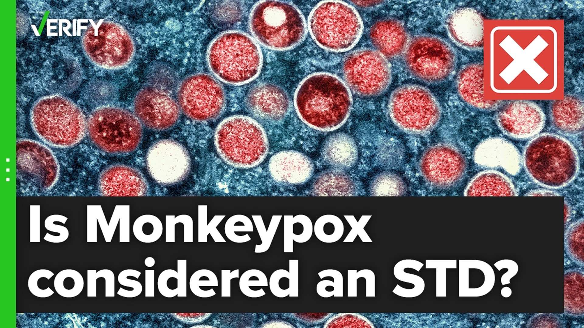 Is Monkeypox a sexually transmitted disease? The VERIFY team confirms this is false.
